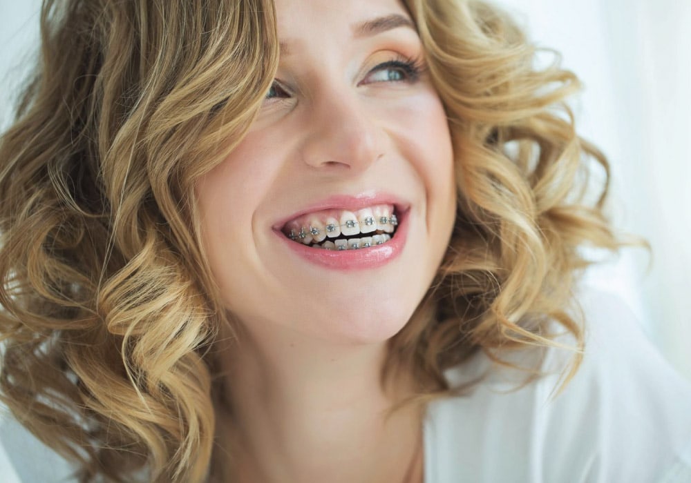 crescent dental and orthodontics lockhart seguin san marcos tx services braces and orthodontics image crescent dental and orthodontics lockhart seguin san marcos tx services braces and orthodontics image