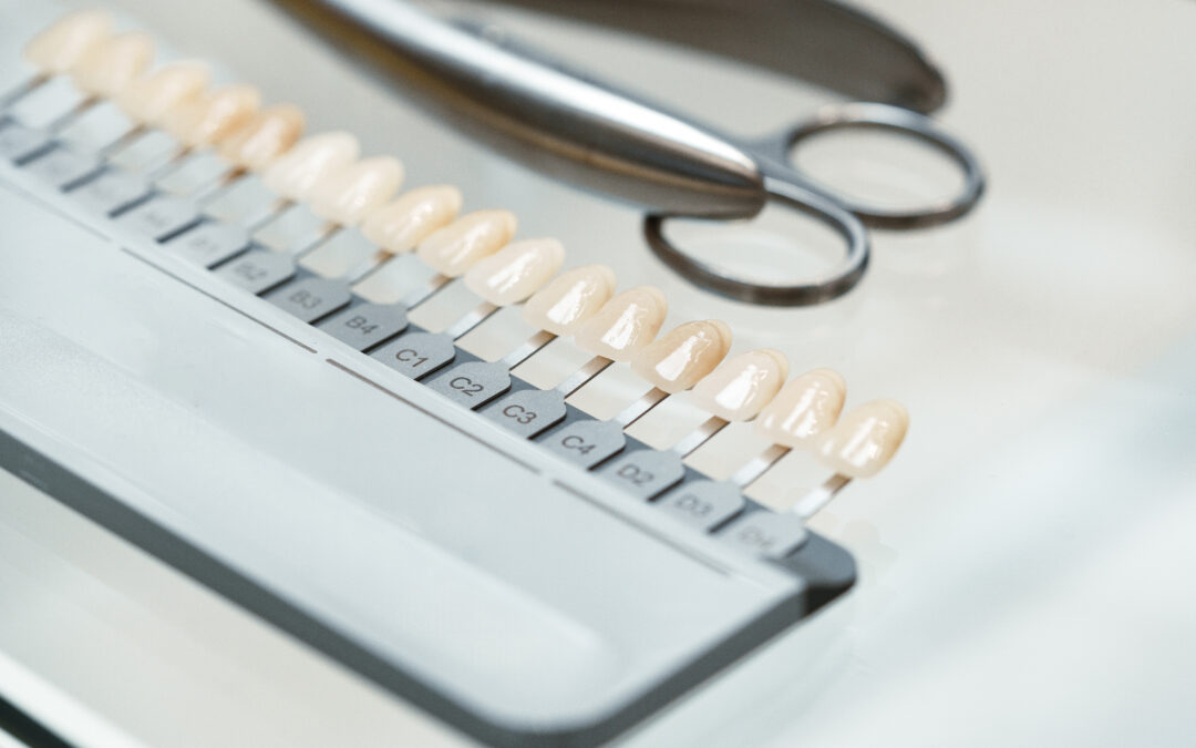 Are Dental Veneers Permanent?