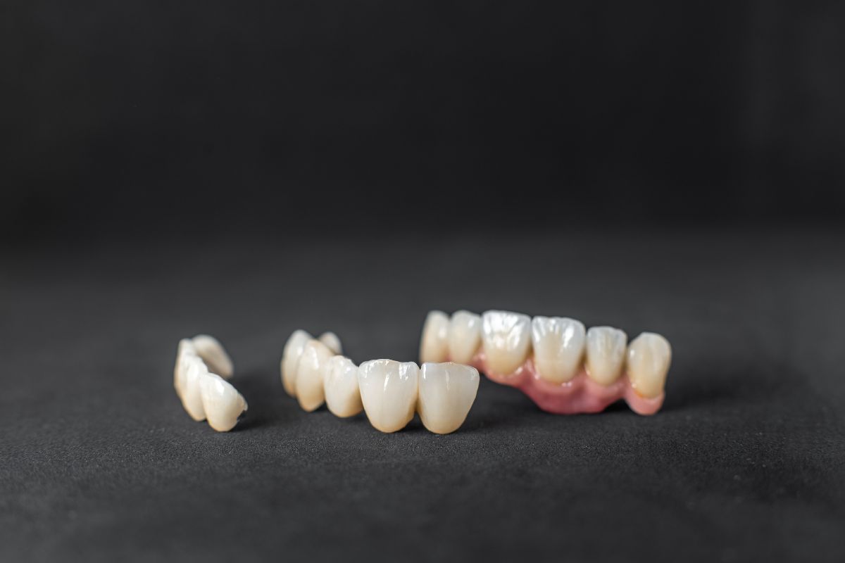 Crowns in San Marcos Dental crowns and bridges displayed in a row against dark background for dental restoration examples.