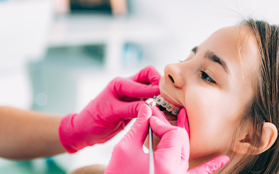 Are Braces Painful for Teens? What Dentists Want Parents to Know