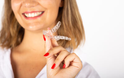 How to Track Invisalign Progress at Home