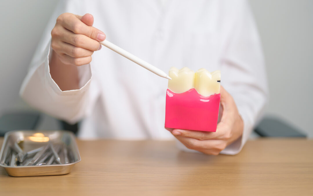 Diet & Dental Health: What Dentists Want You to Know