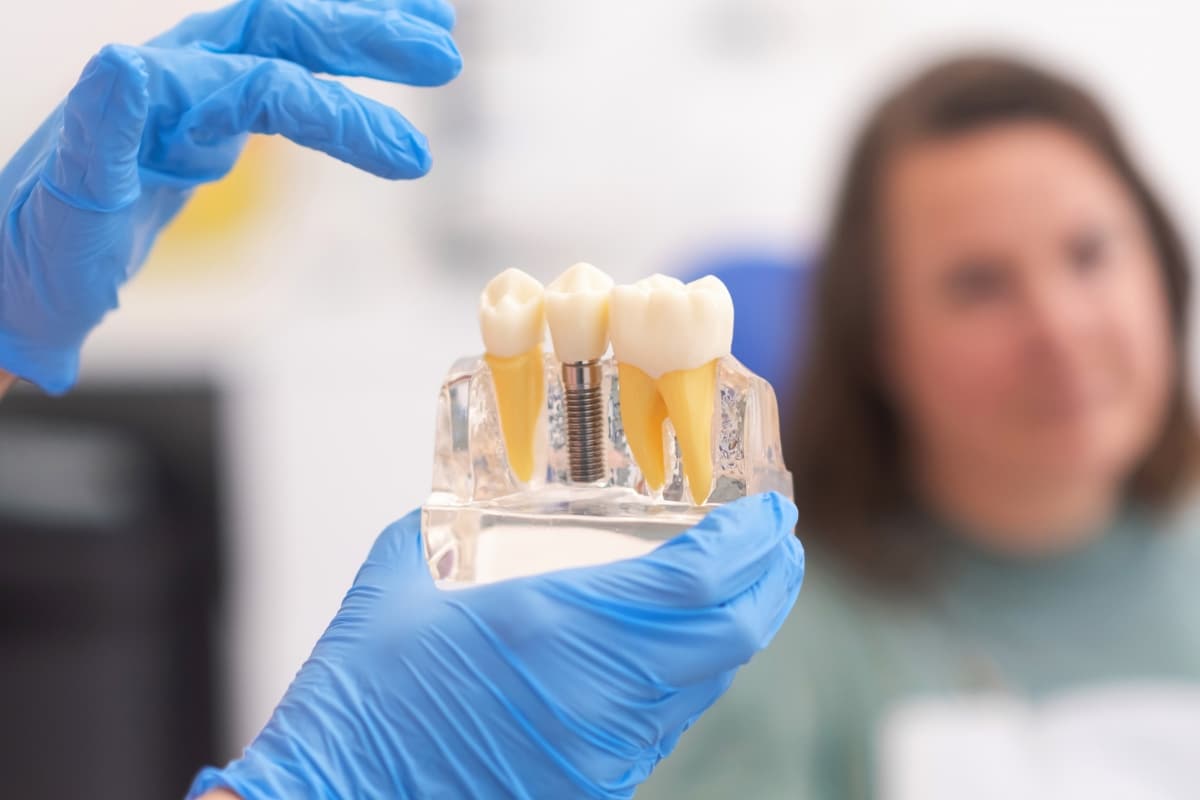 Dental Implant After Years of Tooth Loss